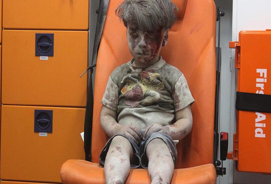 Halep'te Ümran gibi 100 binden fazla çocuk var