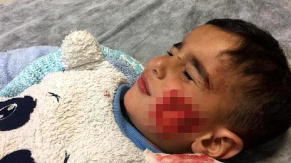 Şanlıurfa'da köpek saldırısına uğrayan küçük Davut, kurtarılamadı