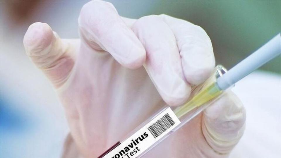 PCR zorunluluğu kalktı
