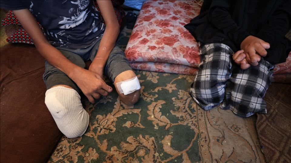 Filistin Sağlık Bakanlığı: Gazze nüfusa oranla dünyada en fazla ampute çocuk sayısına sahip