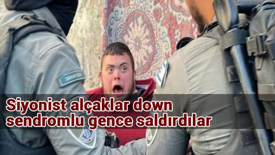 Zafer direnişin.. / Siyonist alçaklar down sendromlu gence saldırdılar