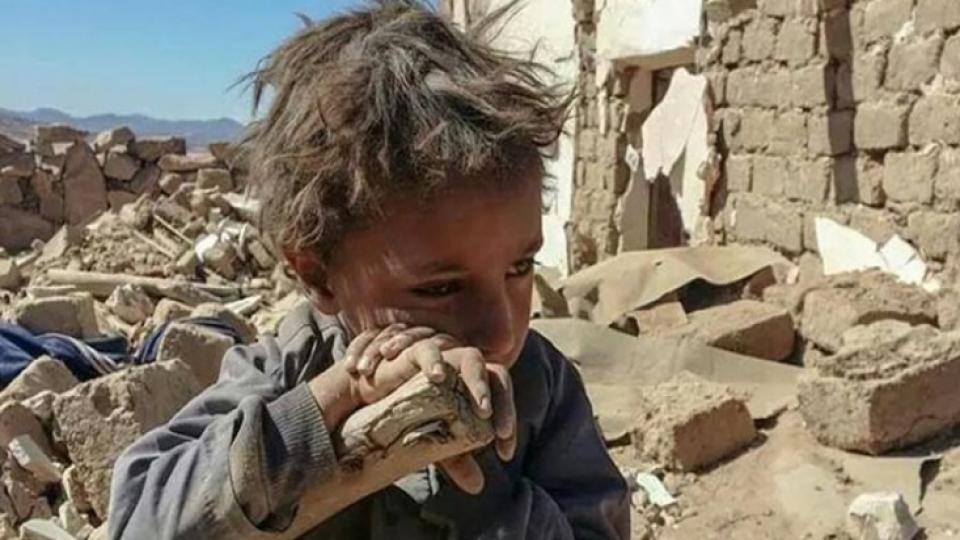Yemen'de yaşananlardan dolayı ABD ve Batı, insan haklarından bahsedemez