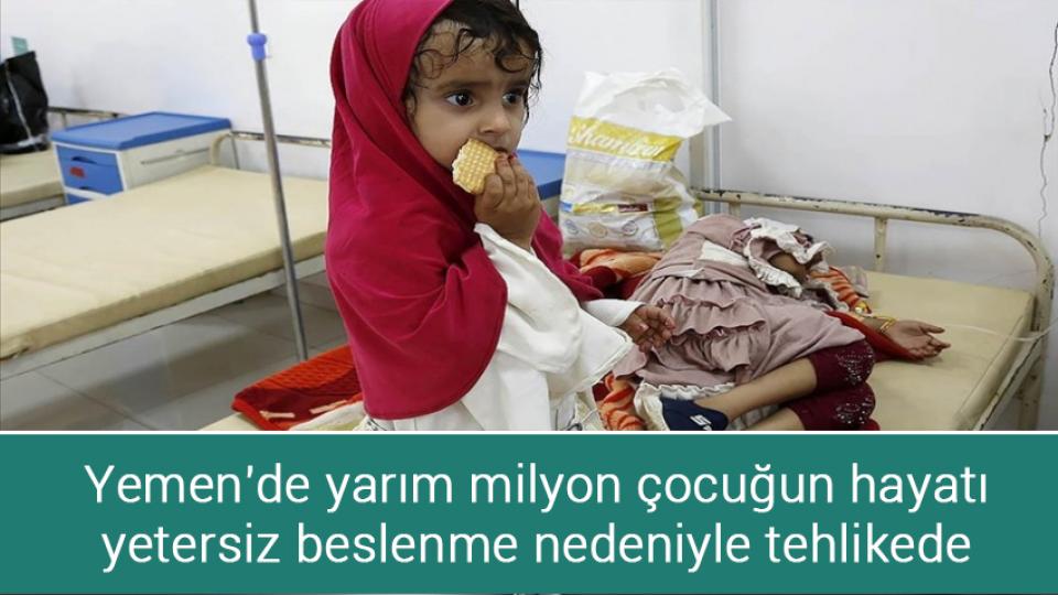 Yemen'de yarım milyon çocuğun hayatı yetersiz beslenme nedeniyle tehlikede